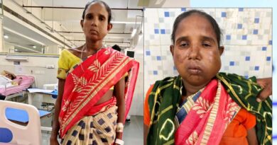 रायपुर: संजीवनी बना मेगा सुपर स्पेशलिटी हेल्थ कैंप, बुधरी मड़कम को मिला नया जीवन