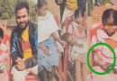 पत्थर शरीर वाली बच्ची के उपचार को लेकर बाल आयोग सक्रिय