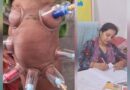 लोहरसी आयुर्वेदिक औषधालय में दर्द प्रबंधन हेतु कपिंग थेरेपी एवं विशेष आयुर्वेदिक उपचार सेवाओं का आरंभ