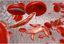 Sickle Cell Disease: देश के 59% मरीज ओडिशा और MP में मिले, 7.27 करोड़ लोगों की हुई जांच